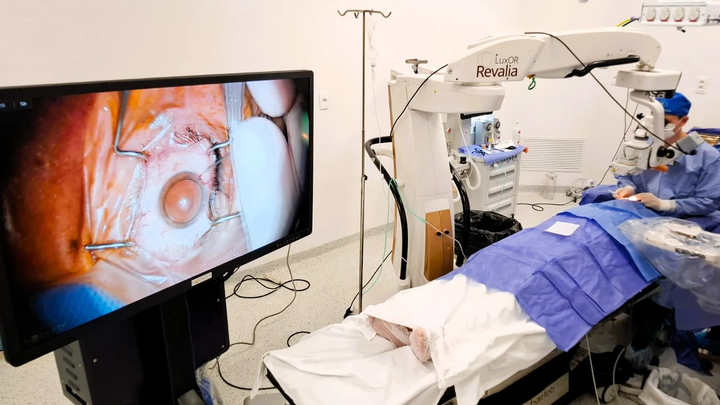 Más de 2.000 cirugías en centro de referencia a nivel país permiten que pacientes recuperen la visión